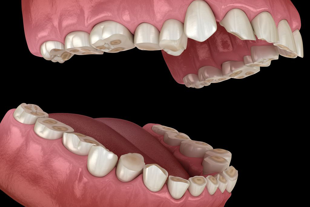 放置すると起こりやすいトラブル